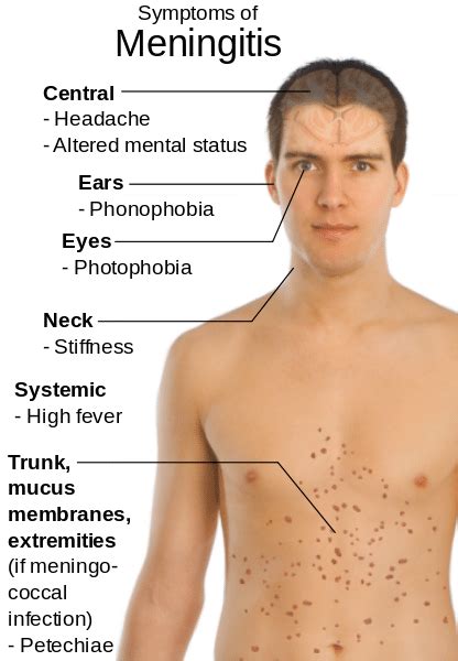 meningitis symptoms adult female